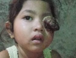 Kades Pagenjahan Sambangi Anak Menderita Penyakit Tumor Mata Berharap Dapat Penangan Khusus Dari Dinas Kesehatan