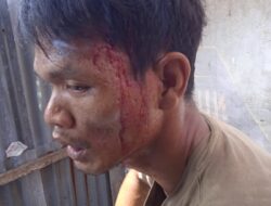 Memanas! Warga Belawan Resah Tawuran Pemuda Diduga Dipicu Persaingan Narkoba