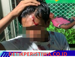 Tiga Orang Terduga Tersangka Pelaku Dewasa Teridentifikasi, Melakukan Pengeroyokan Dan Penganiayaan Serta Kekerasan Terhadap Anak Dibawah Umur TKP Belitang, Orang Tua Dan Keluarga Korban ” Proses Hukum Tetap Akan Berjalan ” Meski Ada Upaya Perdamaian